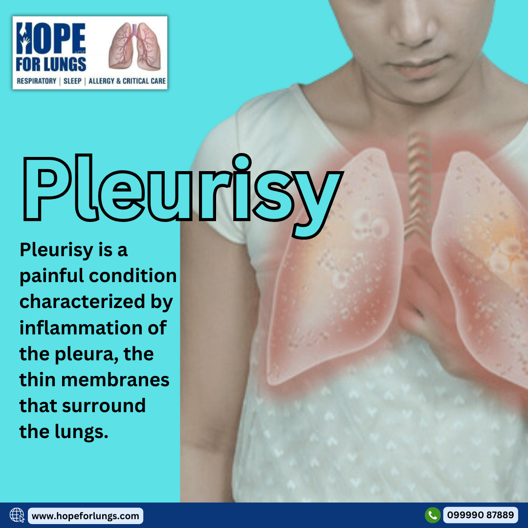 Pleurisy